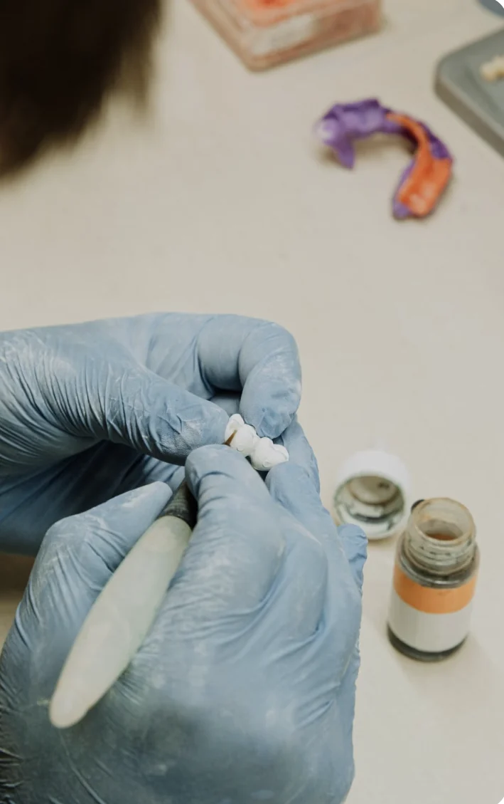 Gloved hands finishing a dental crown with a fine instrument