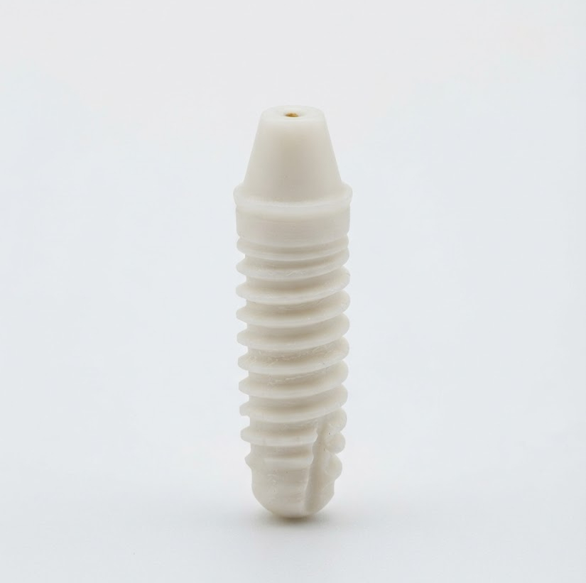 Metal-Free Implant Prosthesis